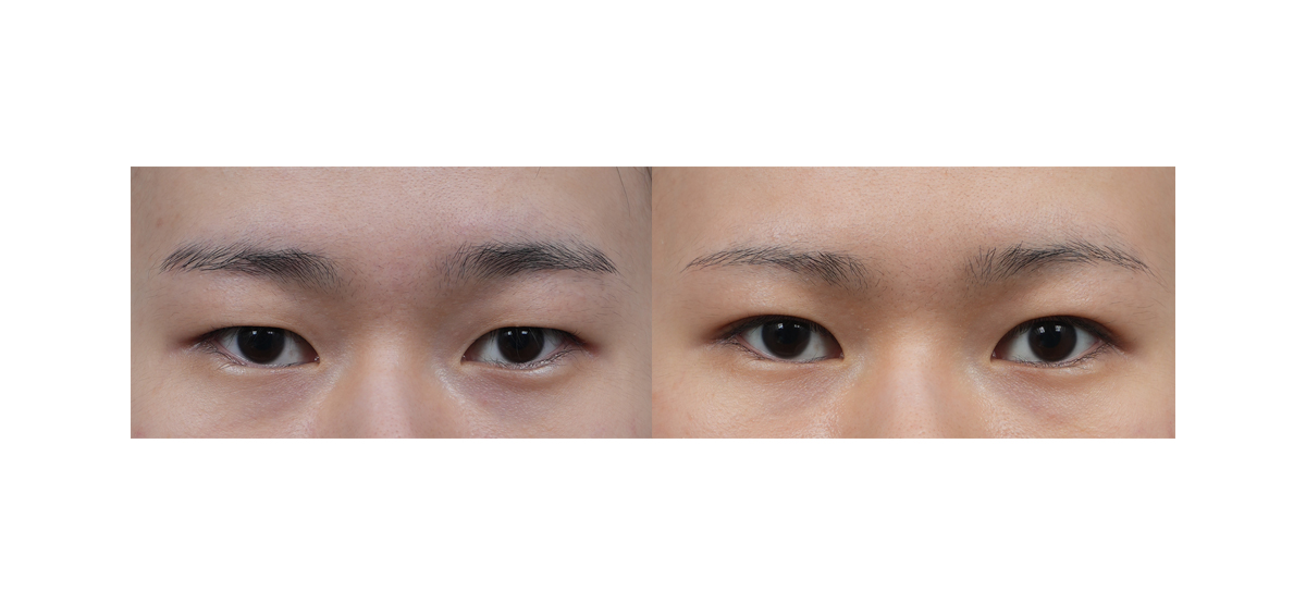 Before Image