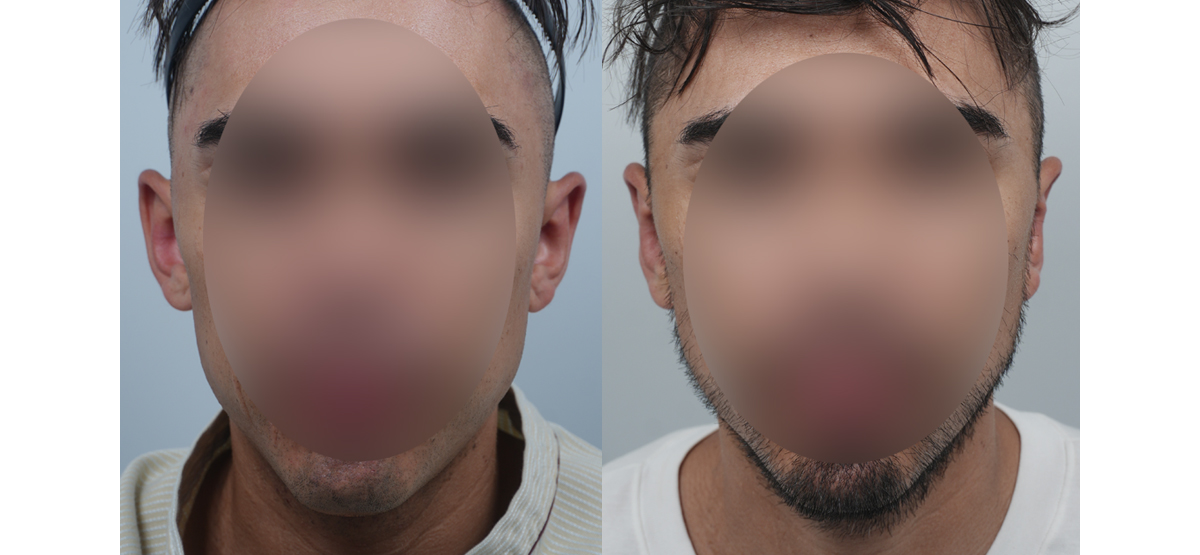 Before Image