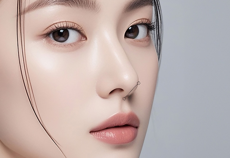 매부리