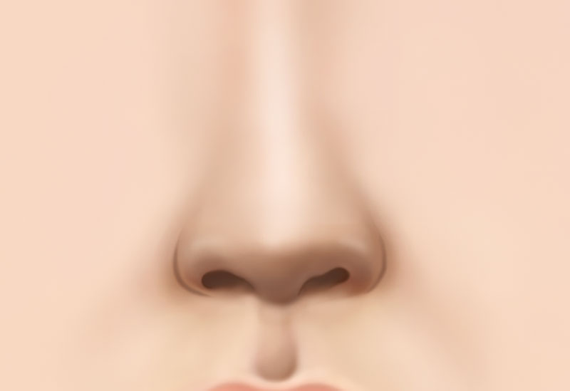 코 재수술