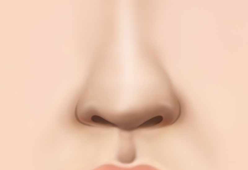코 재수술