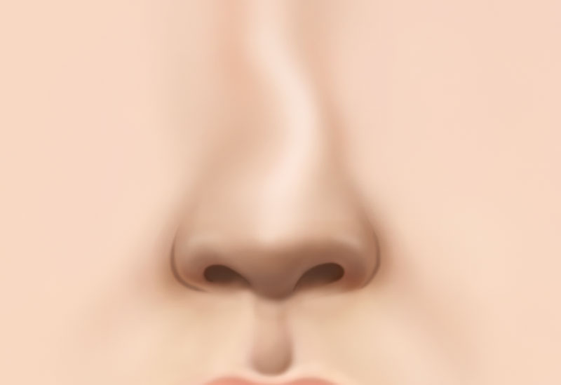 코 재수술