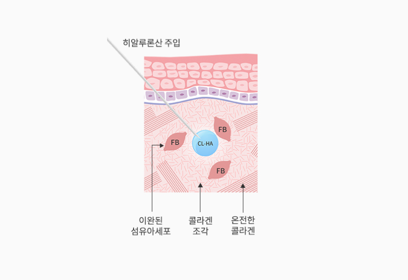 스킨바이브