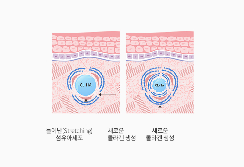 스킨바이브