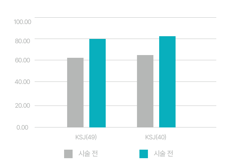 리쥬란힐러