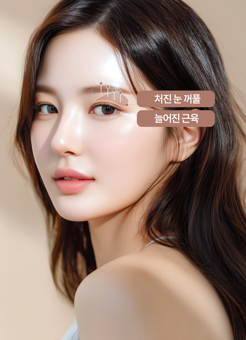 비절개,절개상안검