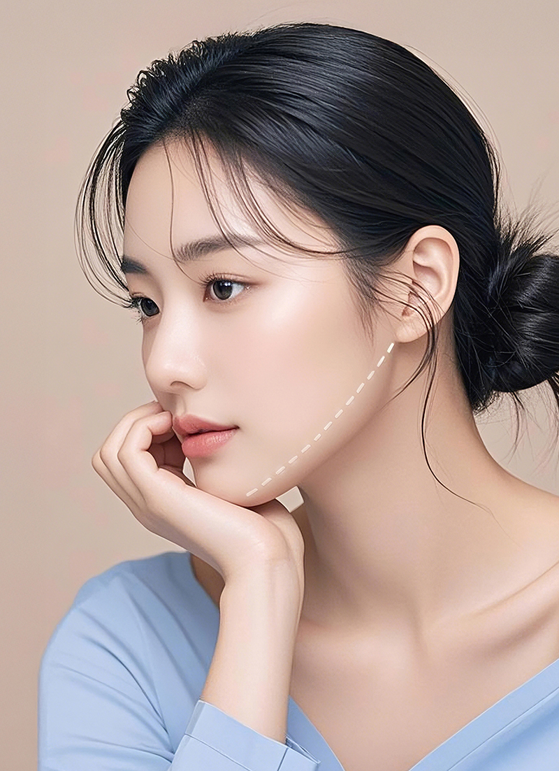 실리프팅