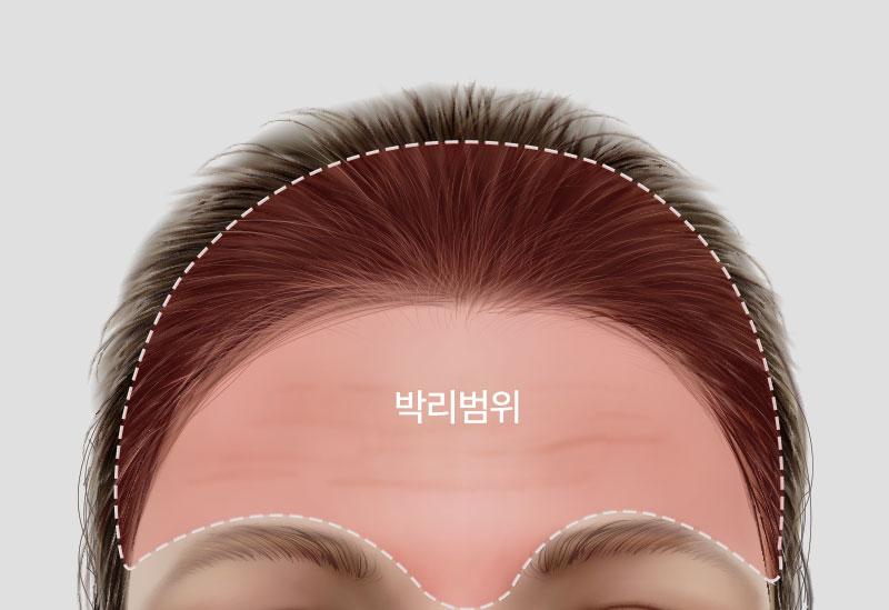이마거상