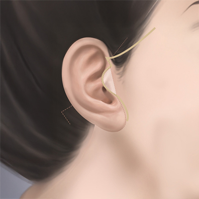 Profile 1